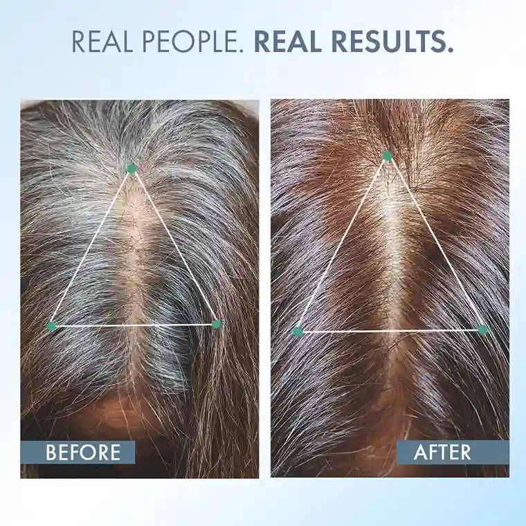 Anti-Grey Hair Prime Serum, 50 ml + Supplements 30N - Image 12
