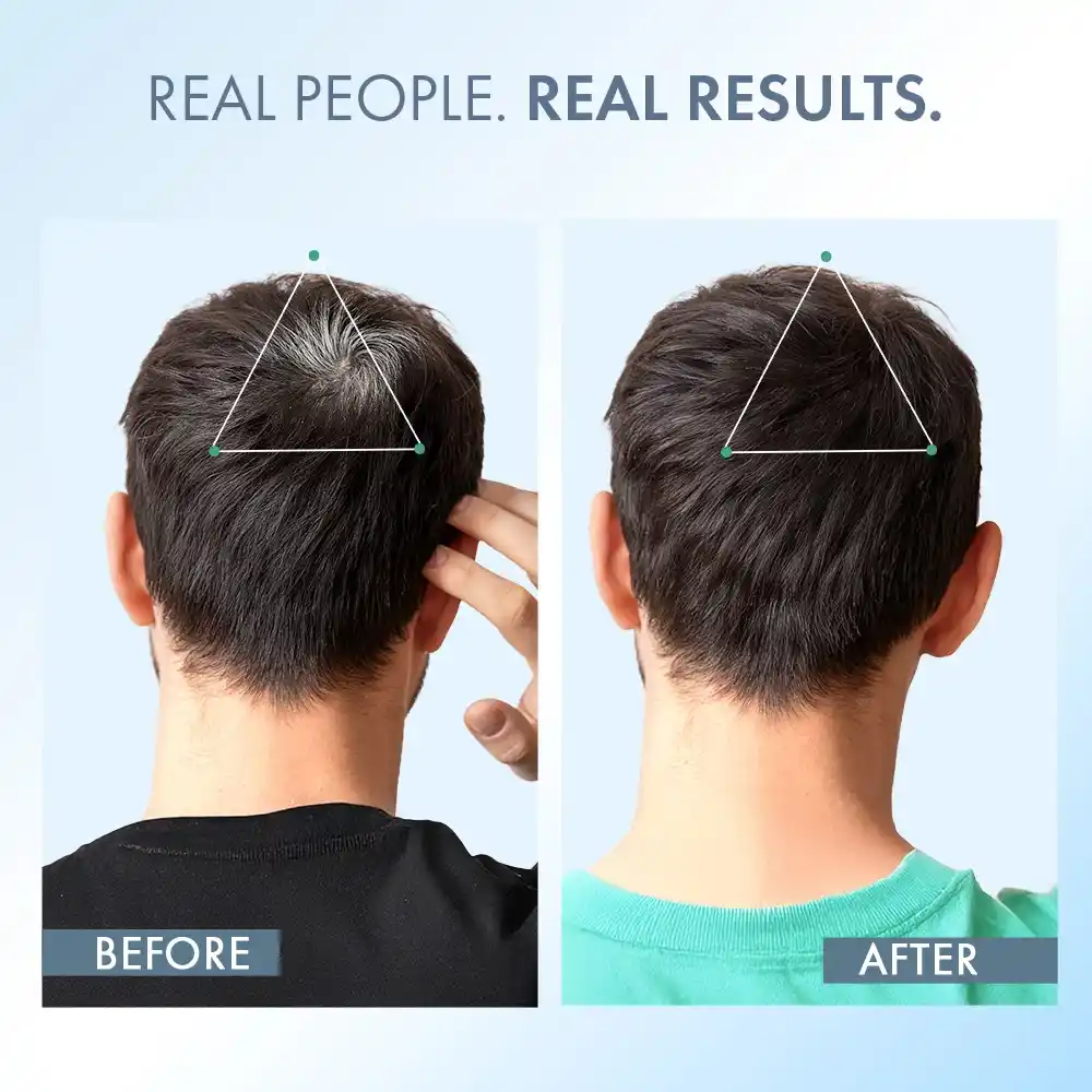 Anti-Grey Hair Prime Serum, 50 ml + Supplements 30N - Image 15