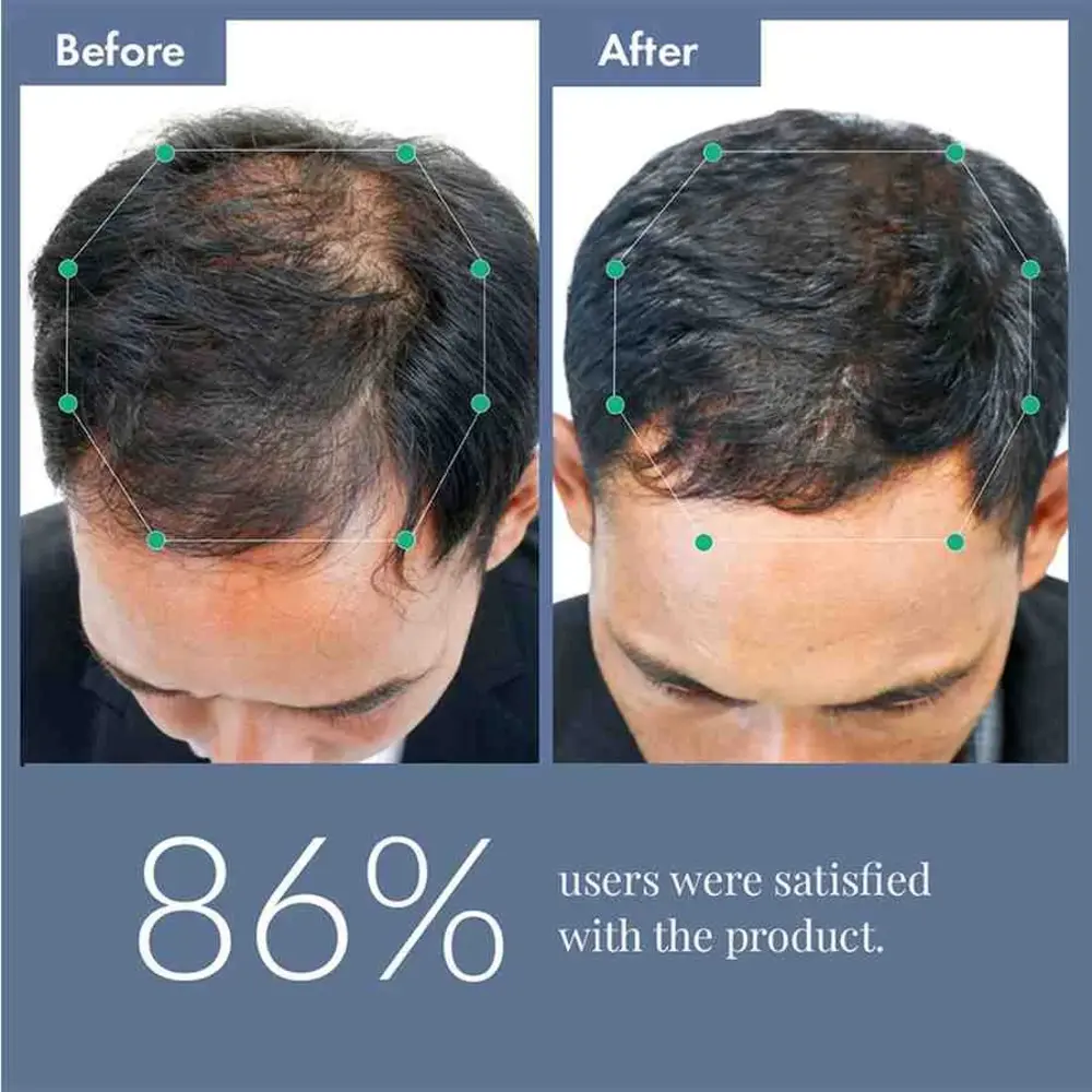 ThriveCo Hair Growth Serum 2.0 For Men | 50ML - Image 10