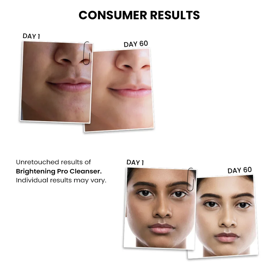 Brightening PRO Cleanser For Women, Pack of 2 - 100 ml each - Image 6