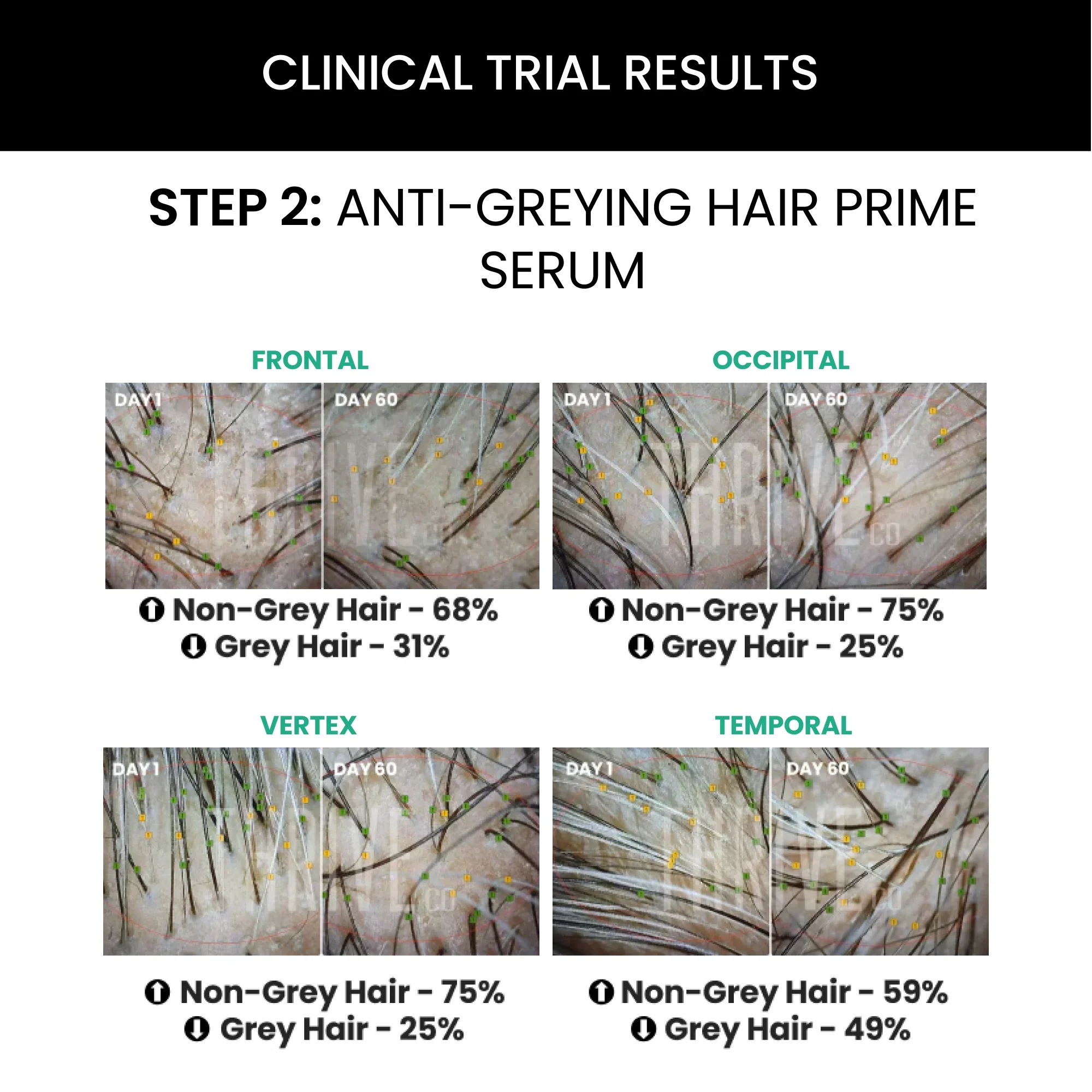 Hair Vitalizing Rosemary Shampoo (250ml) + ThriveCo Hair Prime Serum (50ml) - Image 4