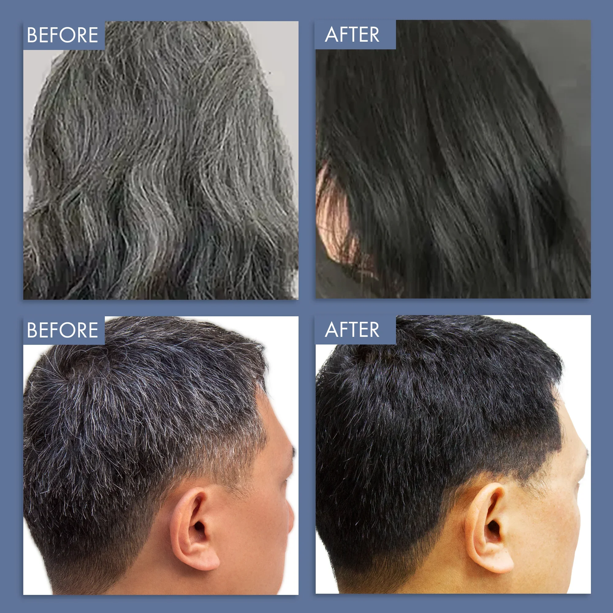 Anti-Greying Trial Kit - Image 10