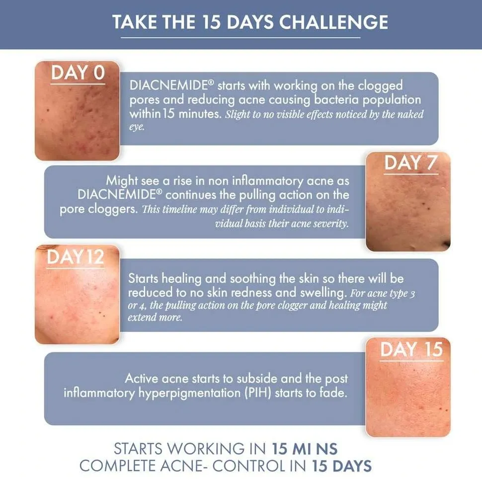 Goodbye Acne Cleanser & Acne Serum - Image 6