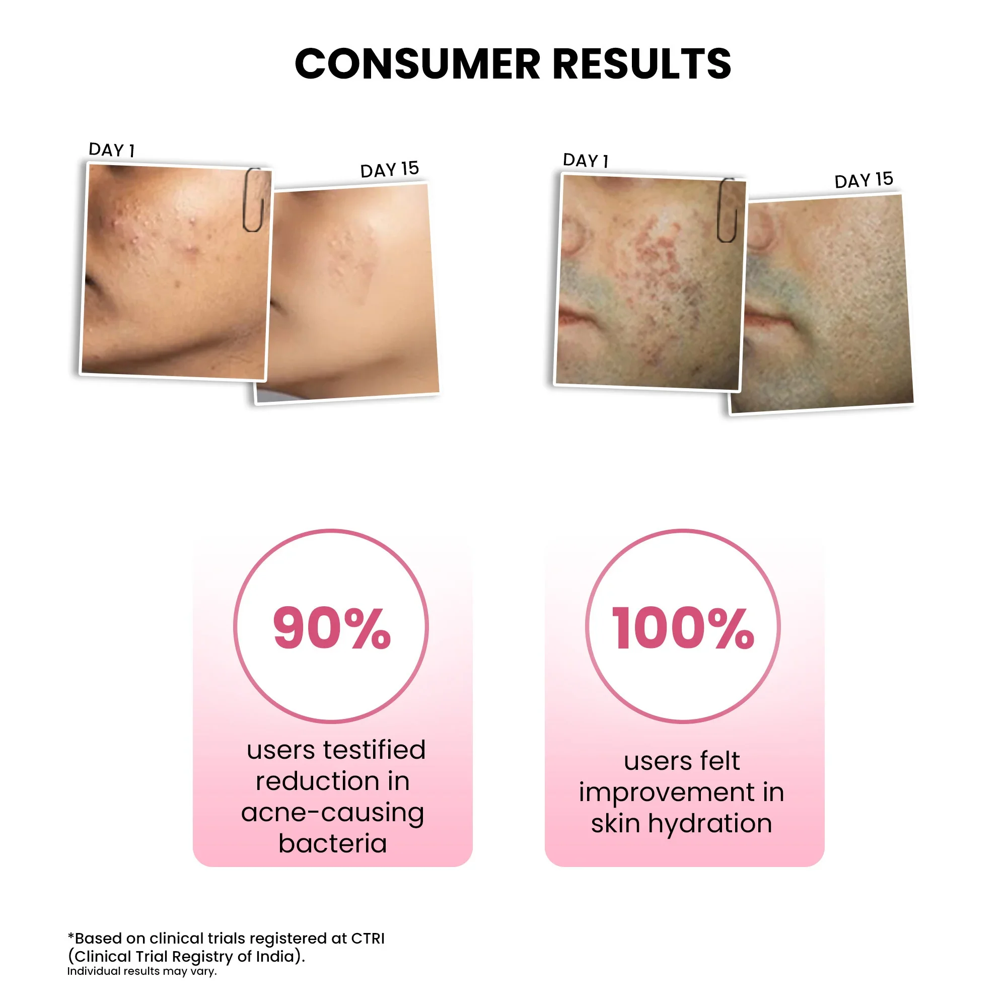 Goodbye Acne Cleanser (25ml) +  ThriveCo Goodbye Acne Serum (10ml) - Image 6