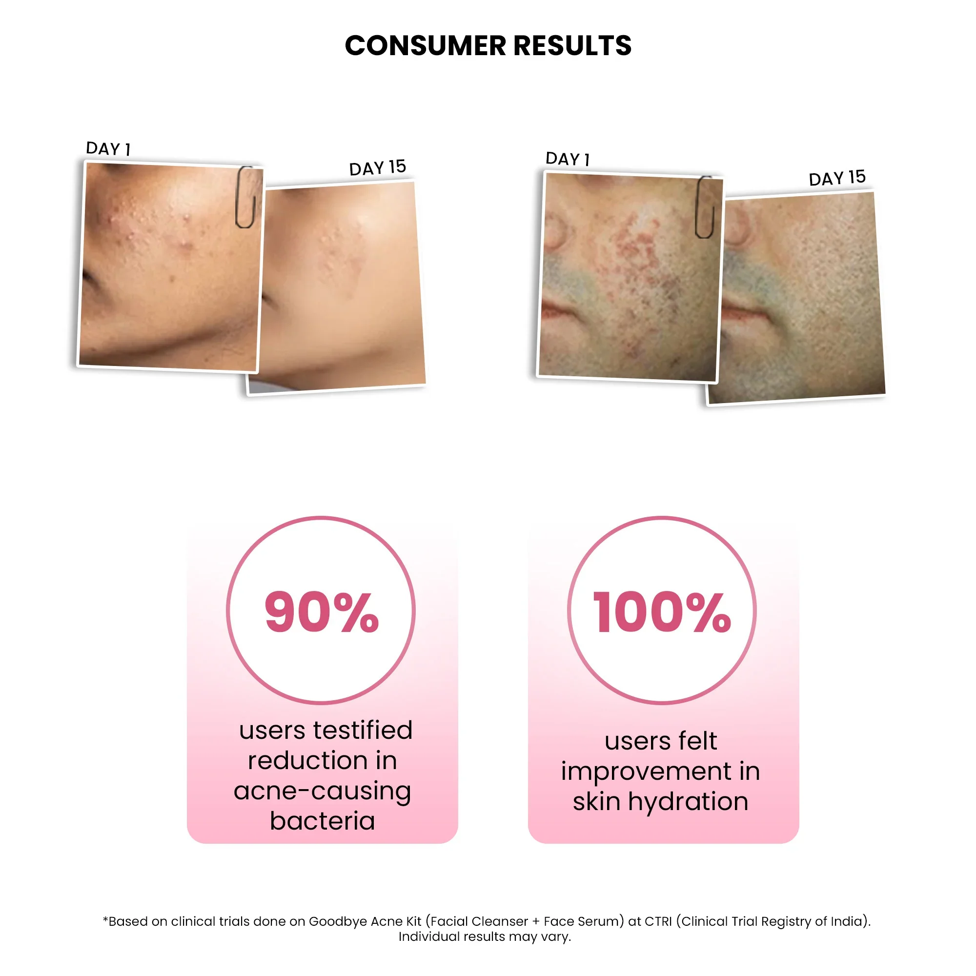 Goodbye Acne Facial Cleanser, 25ml - Image 4