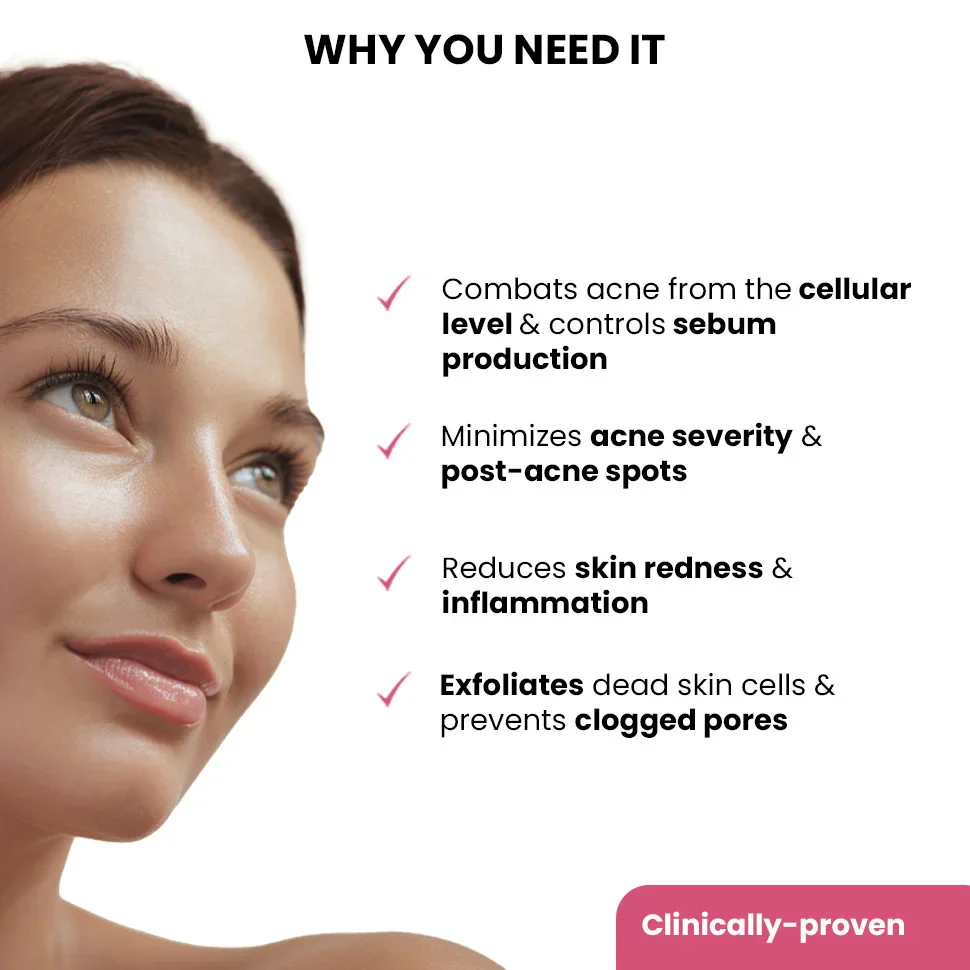 Goodbye Acne Trial Kit - Image 6