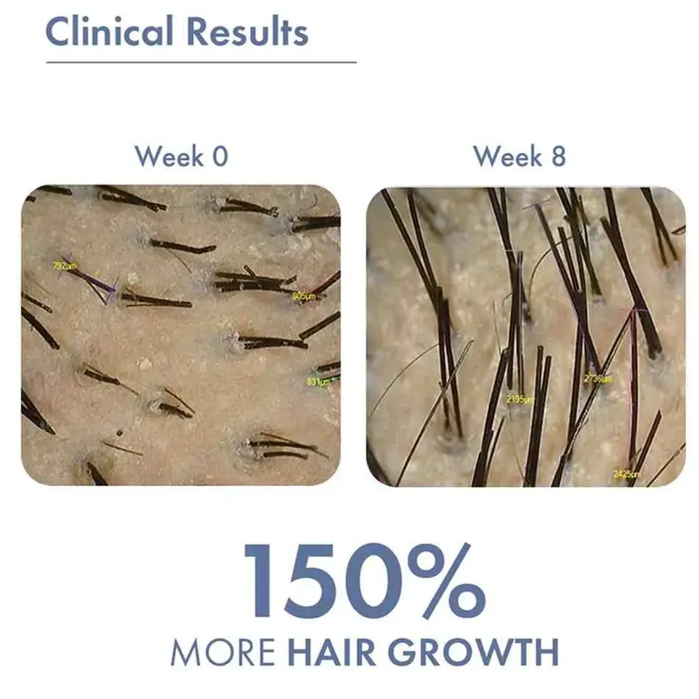 ThriveCo Hair Growth Serum 2.0 For Men | 50ML - Image 5