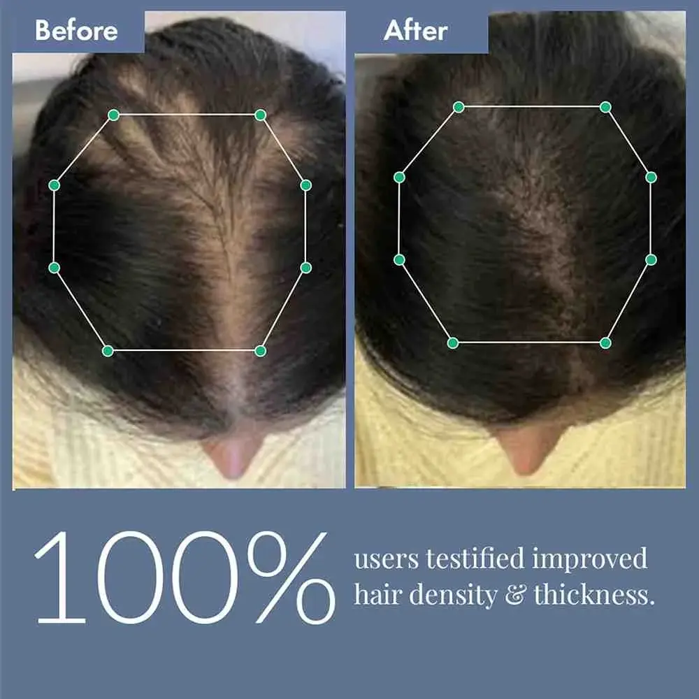 ThriveCo Hair Growth Serum 2.0 For Men | 50ML - Image 7