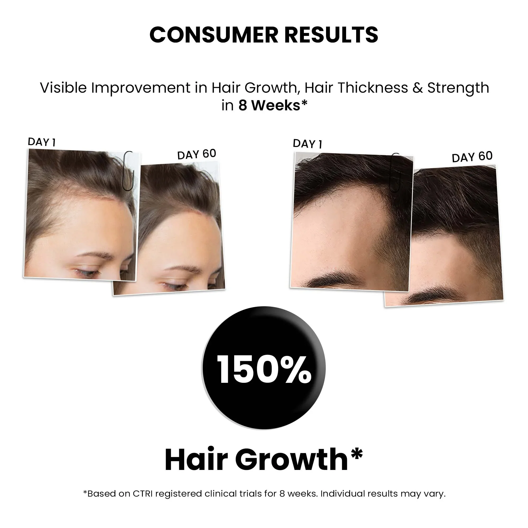 Hair Growth Serum for Men & Women 2.0, 30ML - Image 3