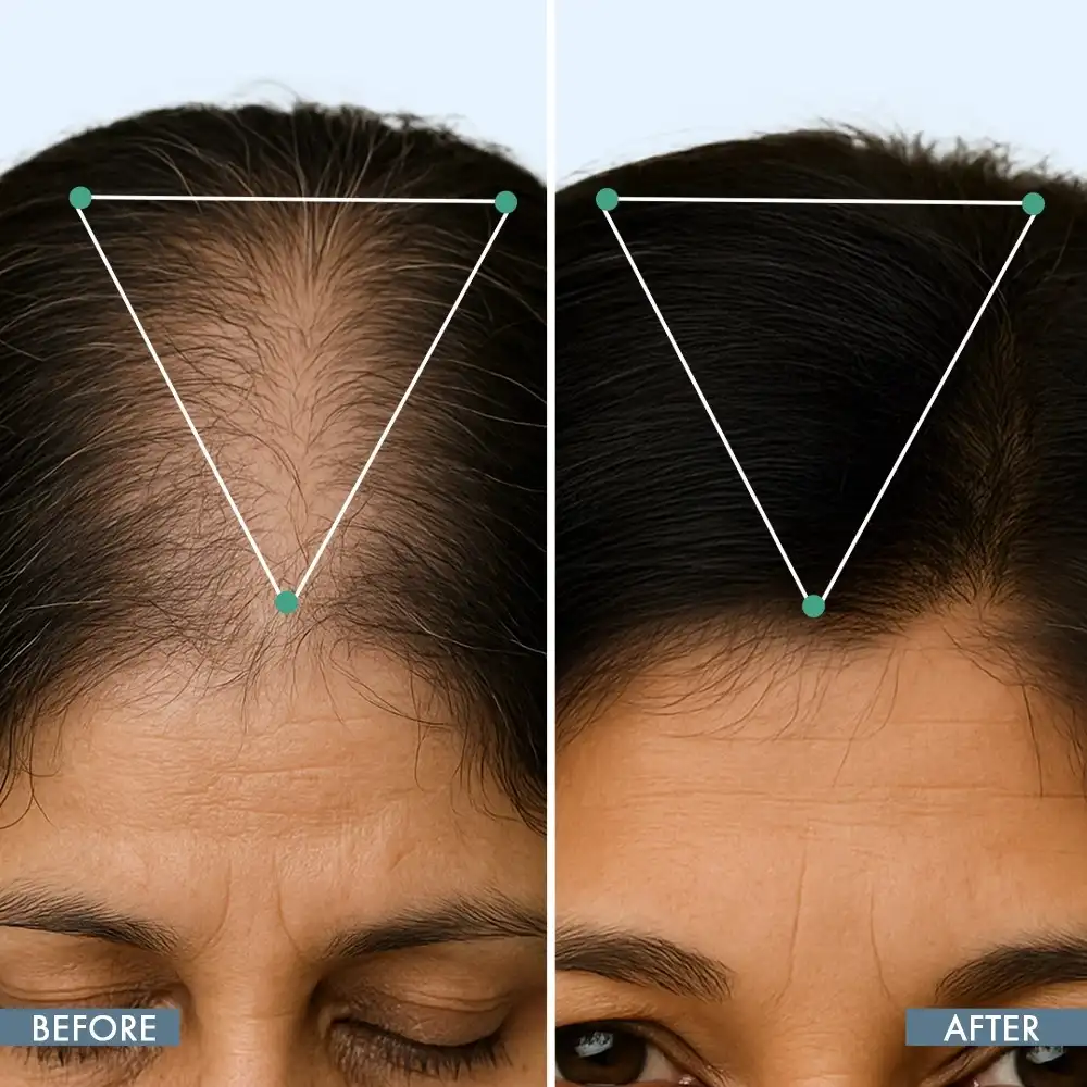 Hair Growth Serum, 50ml + Women's Hair Growth Supplement, 60N + Women's Balance Hair Supplement, 30N - Image 6