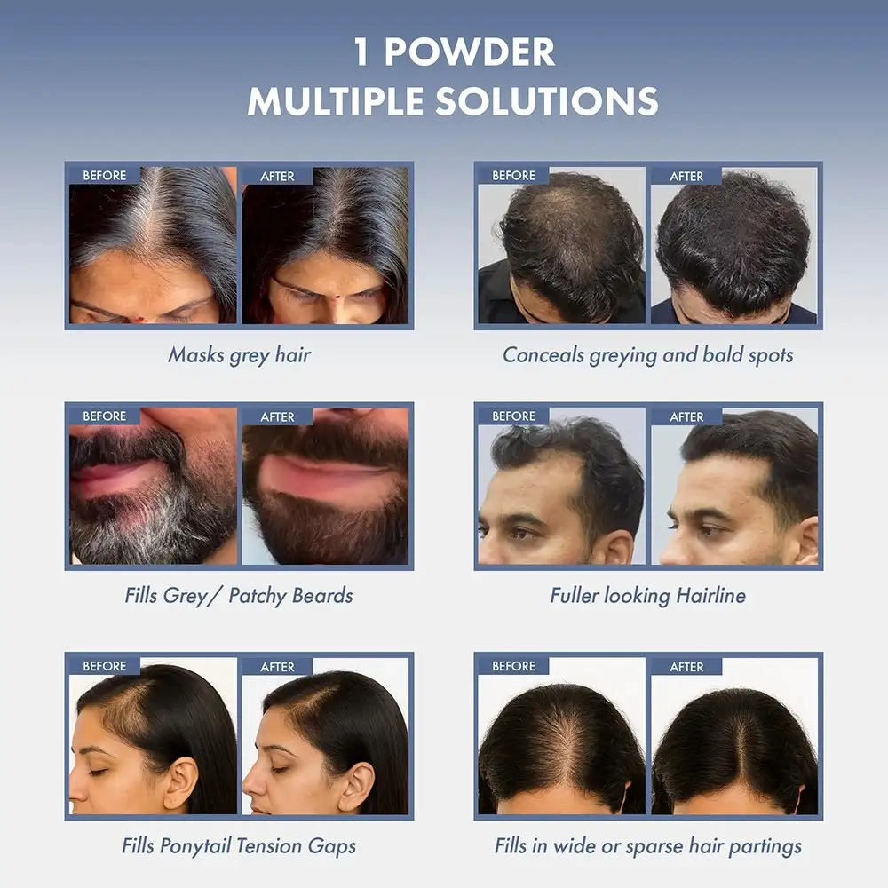 Hair Root Touch Up Powder, 4 Gms - Image 7