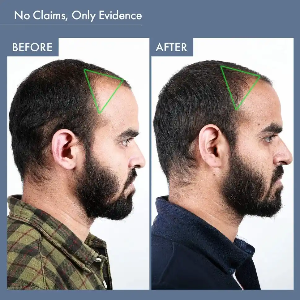 Men’s Hair Growth Solution - Image 8