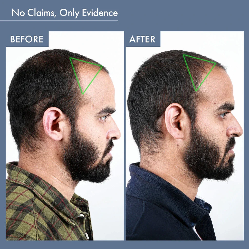 Men's Hair Growth Supplement, 60N Capsules - Image 7