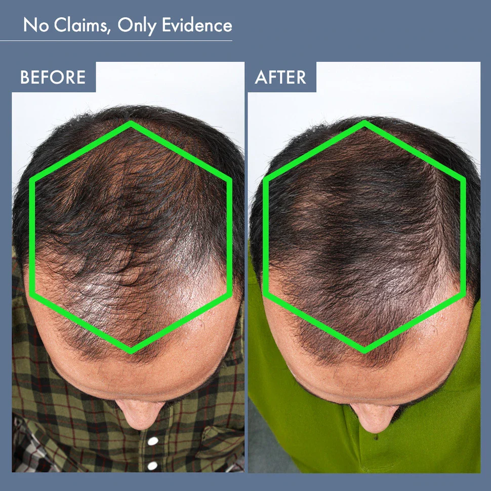 Men's Hair Growth Supplement, 60N Capsules - Image 8