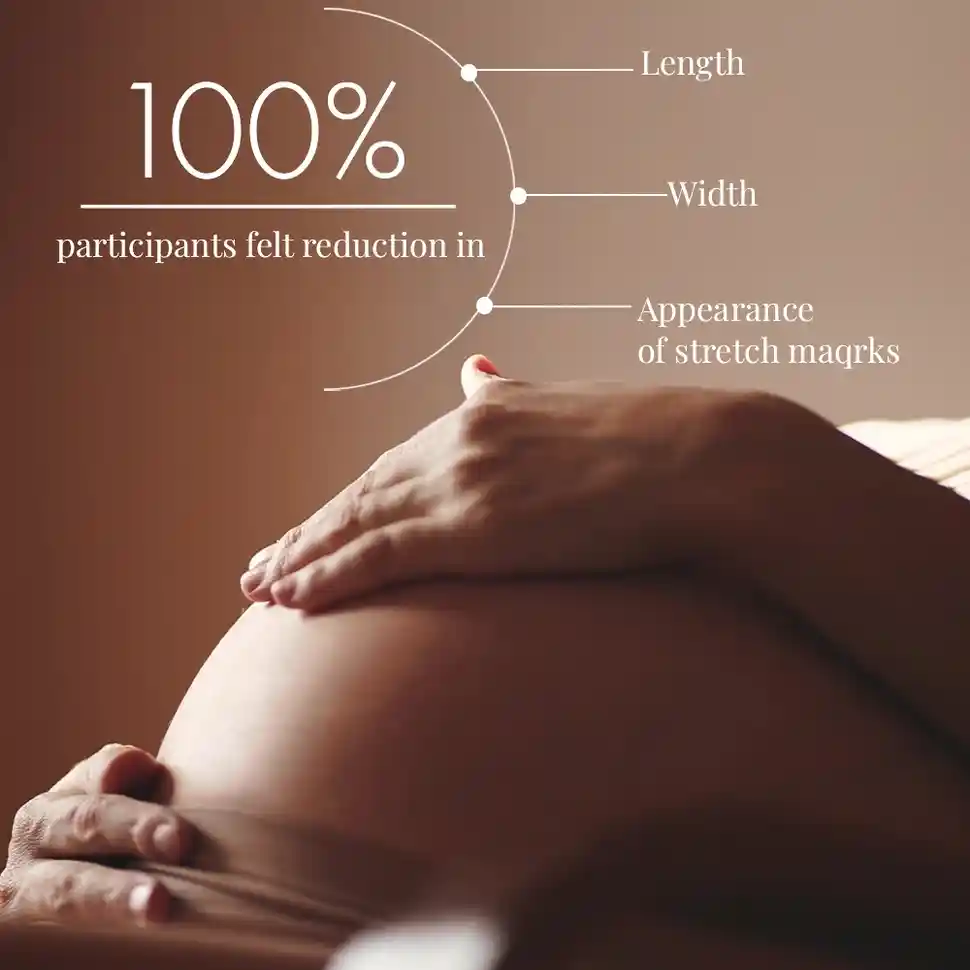 Stretch Marks Expert, Serum Cream, 30ml - Image 10
