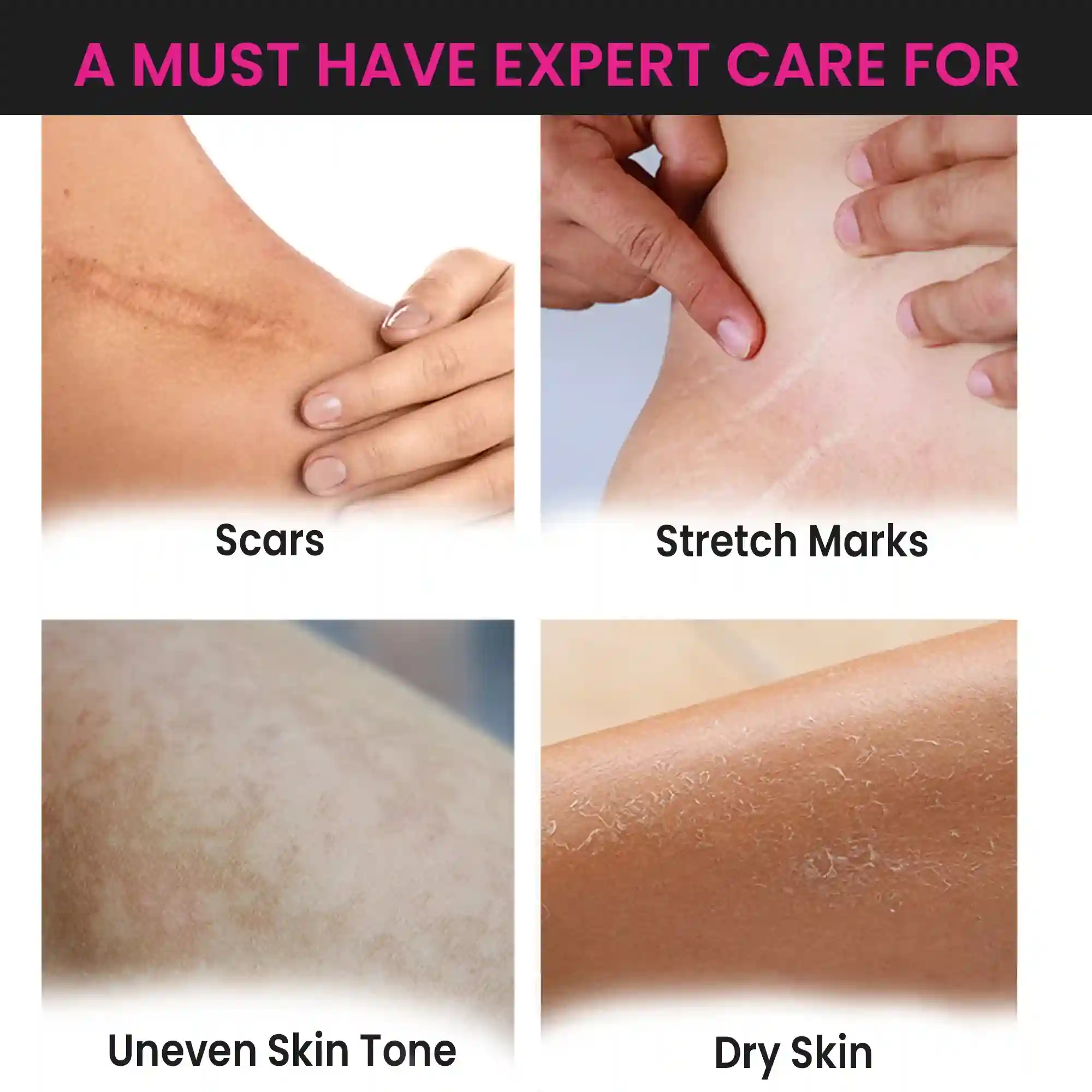 Stretch Marks Trial Kit - Image 8