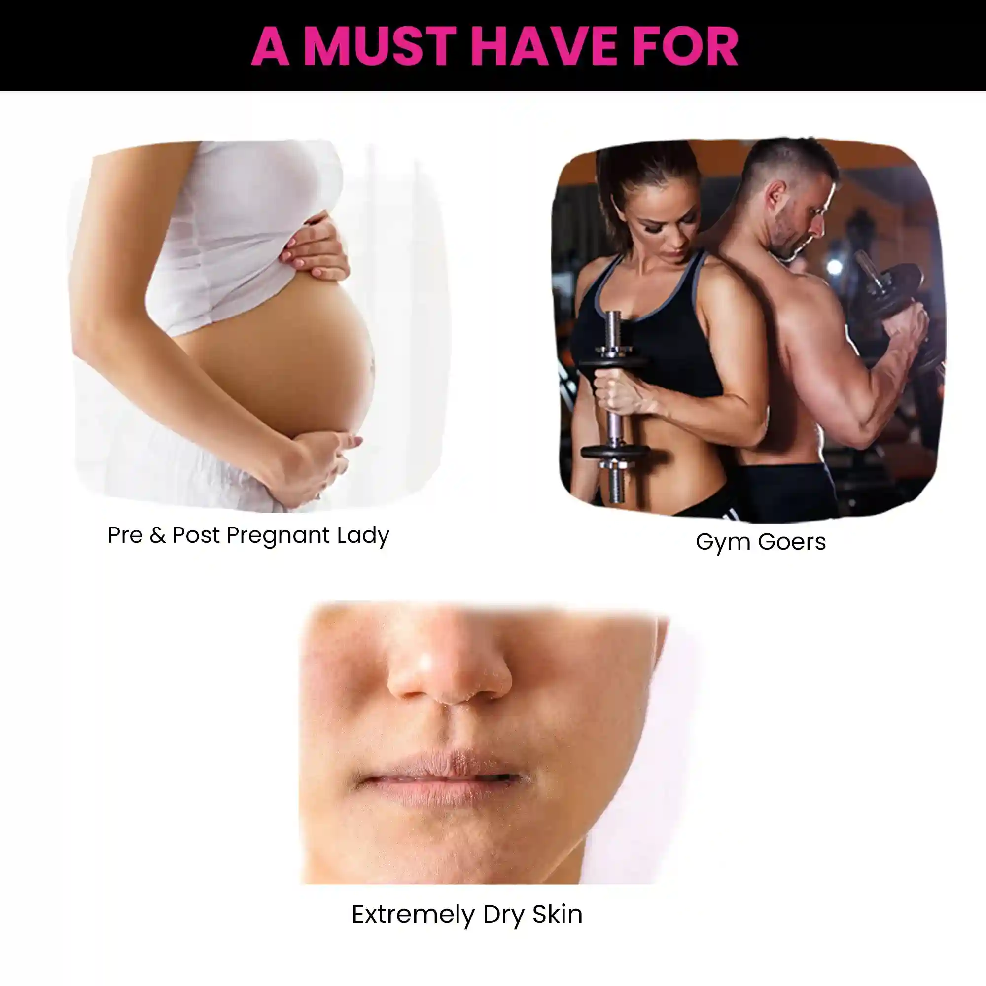 Stretch Marks Trial Kit - Image 9