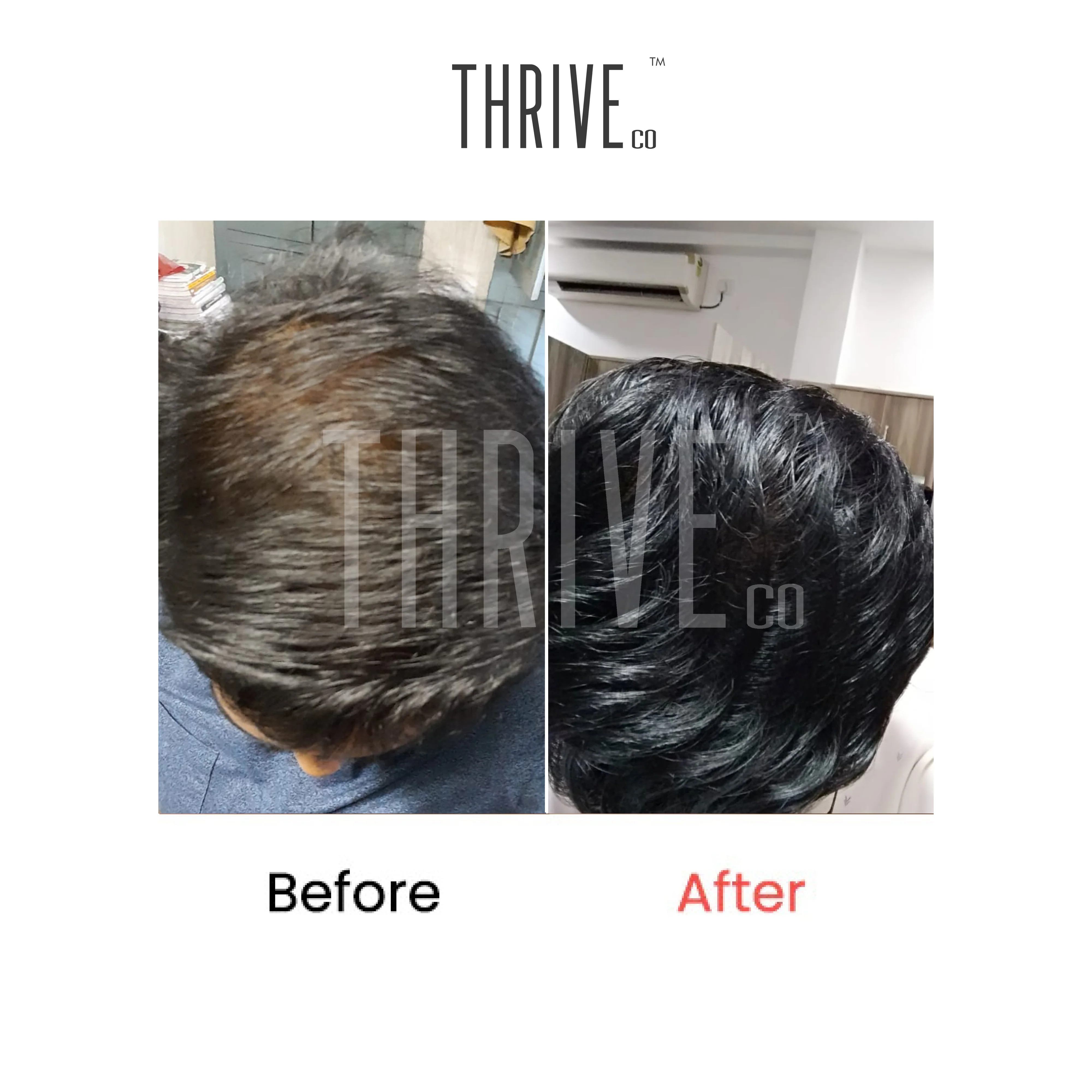 Hair Care Kit: ThriveCo Scalp Scrub (100ml) + Vitalizing Serum (50ml) + Hair Growth Serum (50ml) - Image 3