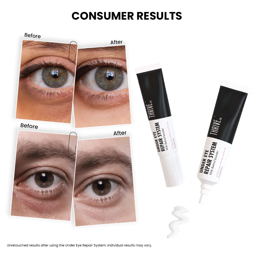 ThriveCo Undereye Repair System, 15 gms - Image 5