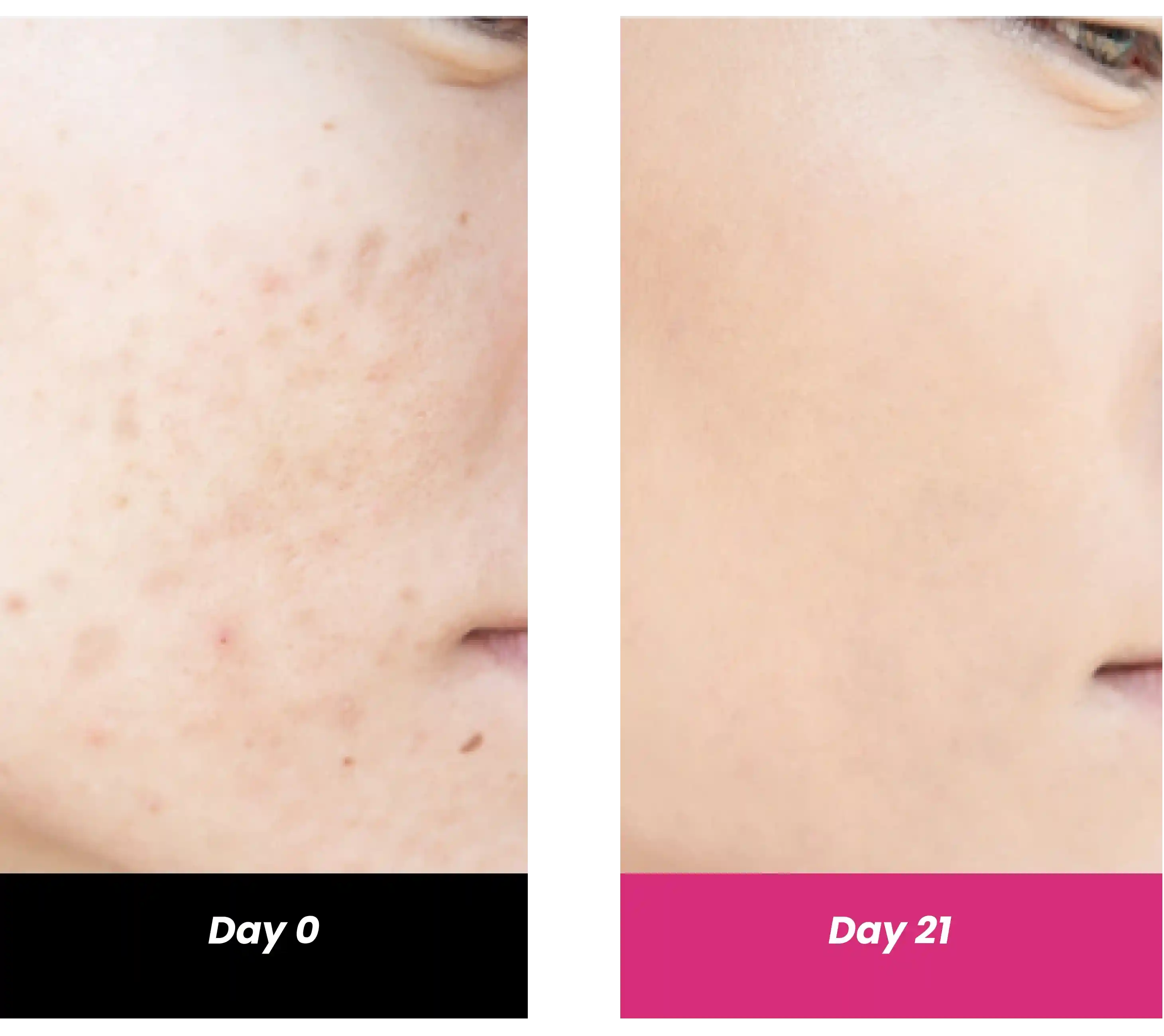 10% Niacinamide Serum with 1% Zinc PCA, 30ml - Image 4