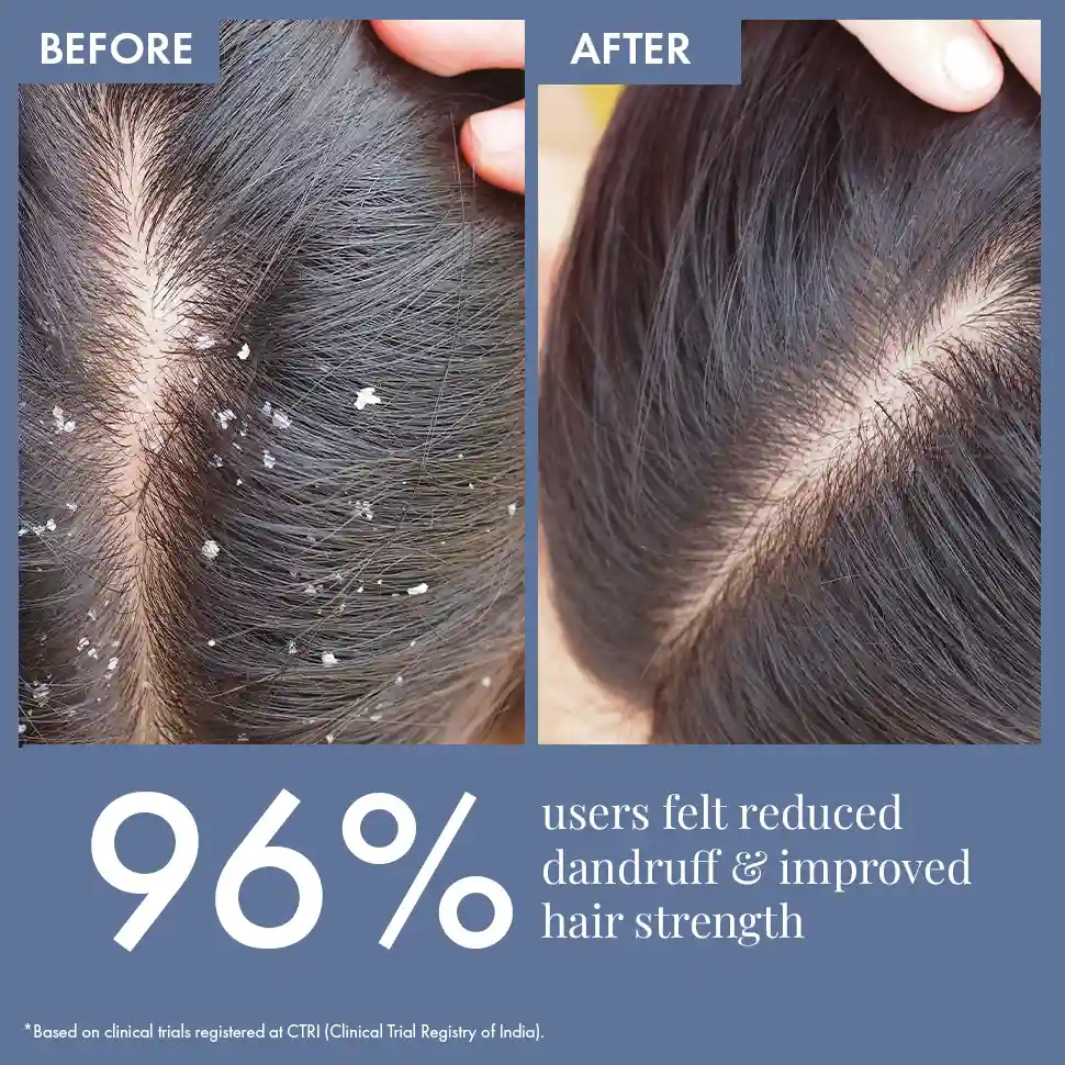 Scalp Clear Shampoo - Image 5