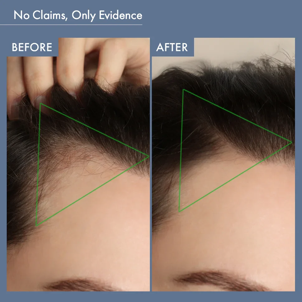 Women’s Balance Hair Growth Solution - Image 8