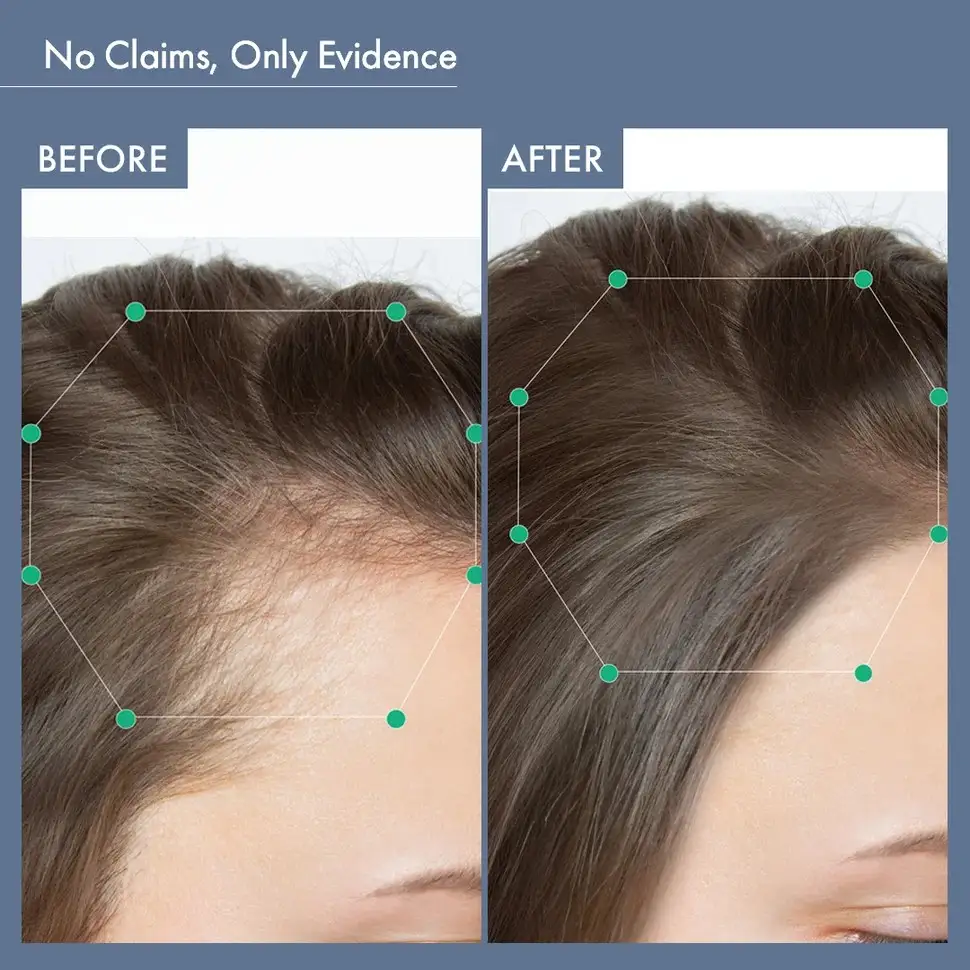 Women’s Hair Growth Solution - Image 7