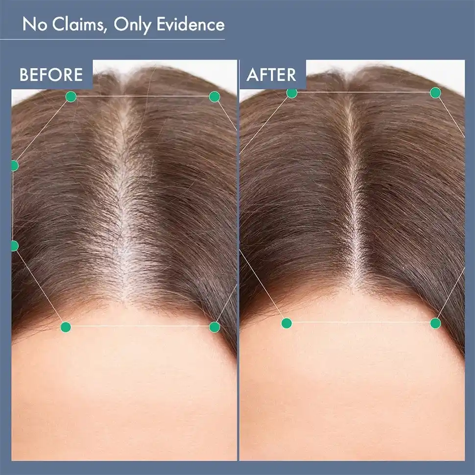 Women’s Post-Partum Hair Growth Solution - Image 7